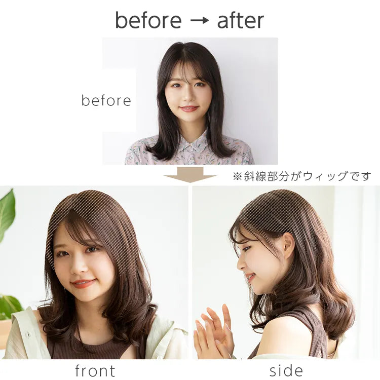 最高級人毛(レミー)100%トップヘアピース（ポイント/医療用ウィッグ