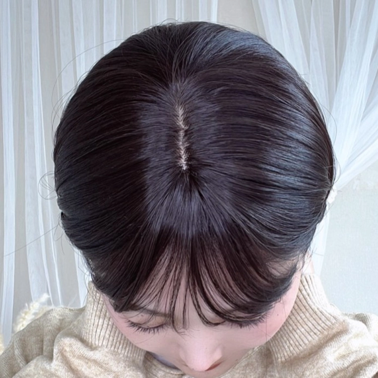 つむじを上から見てみましょう︕