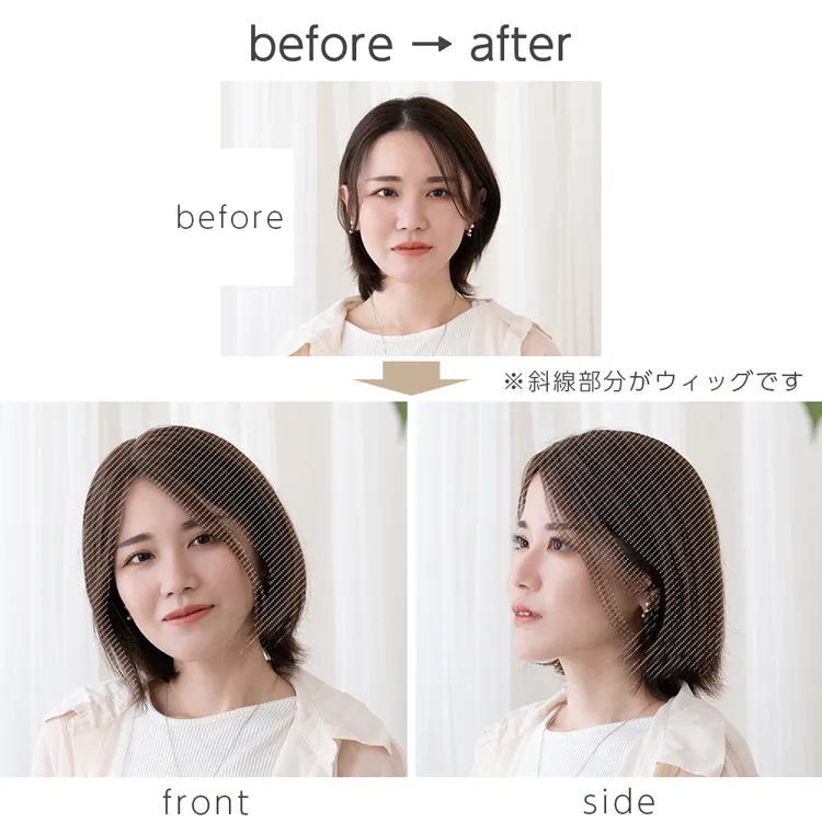 最高級人毛(レミー)100%トップヘアピース（ポイント/医療用ウィッグ