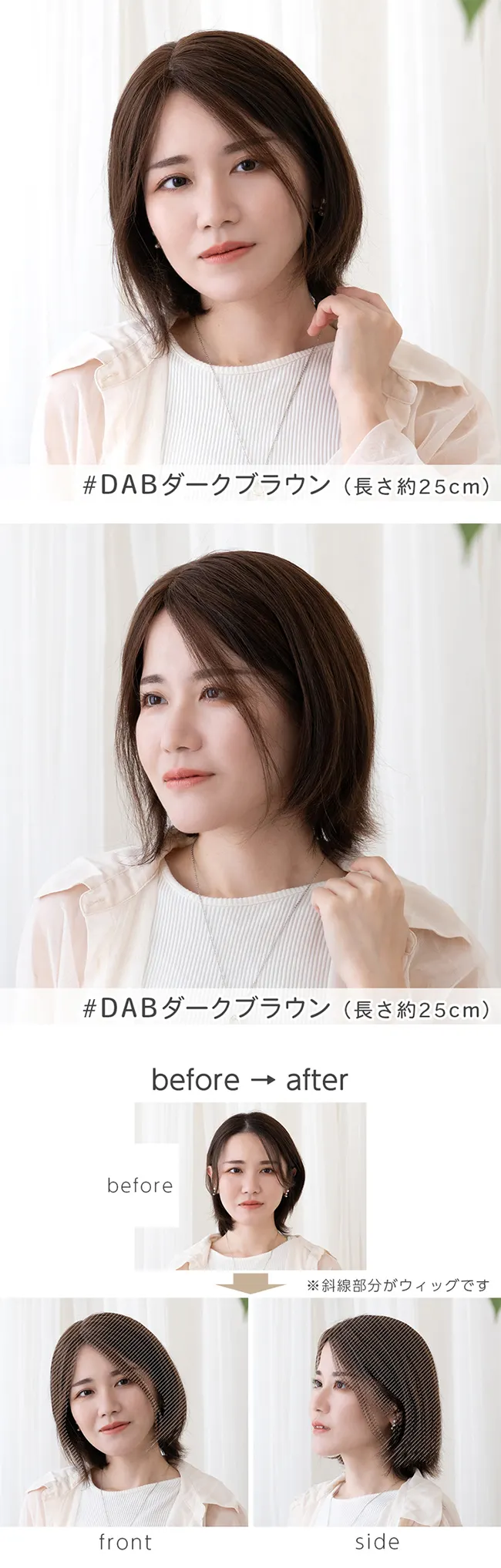 最高級人毛(レミー)100%トップヘアピース（ポイント/医療用ウィッグ